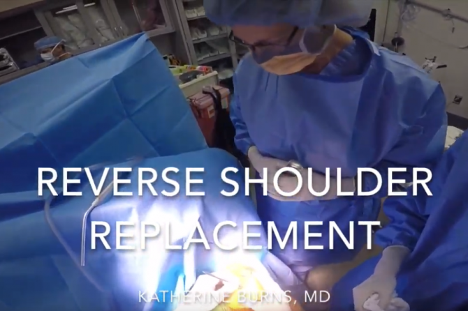 Reverse Shoulder Replacement: Video